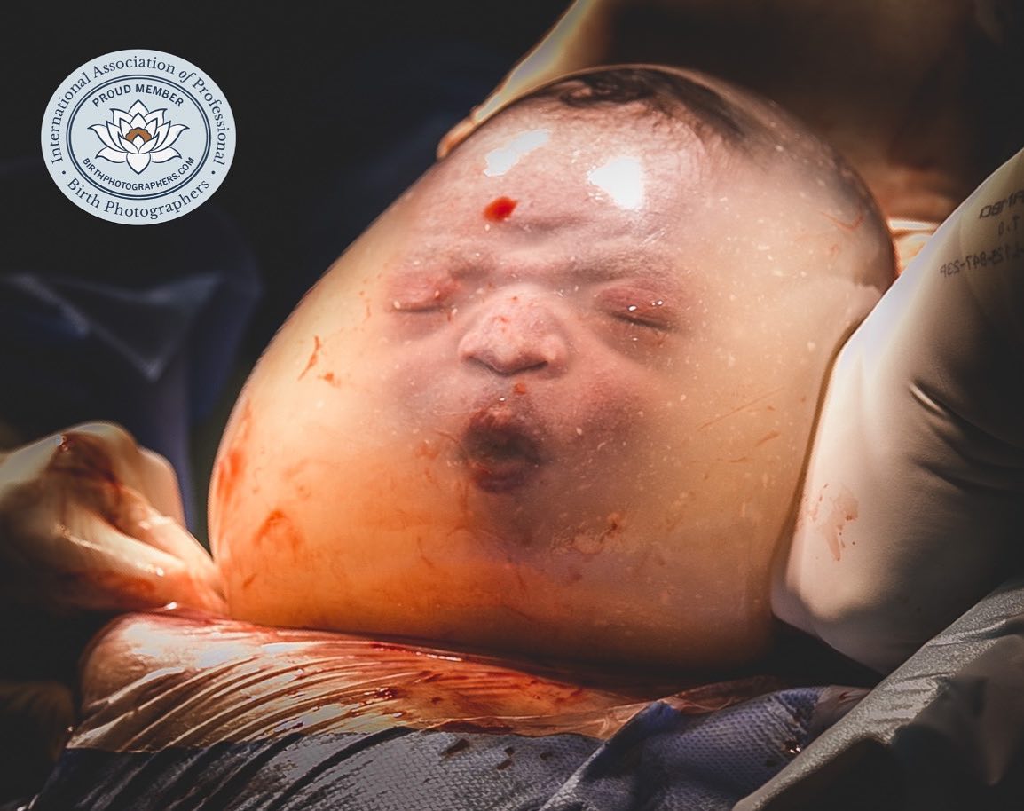 Foto de bebê capixaba empelicado ganha prêmio internacional. Foto: Janaína Brasil