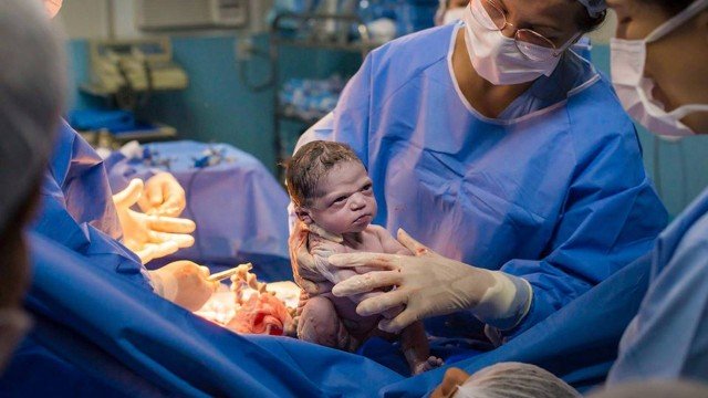 Foto de bebê “zangada” viralizou nas redes sociais. Foto: Facebook/Rodrigo Kunstmann