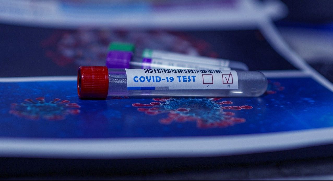 UFMG desenvolve teste que detecta covid-19 pela urina. Foto: Fernando Zhiminaicela/Pixabay