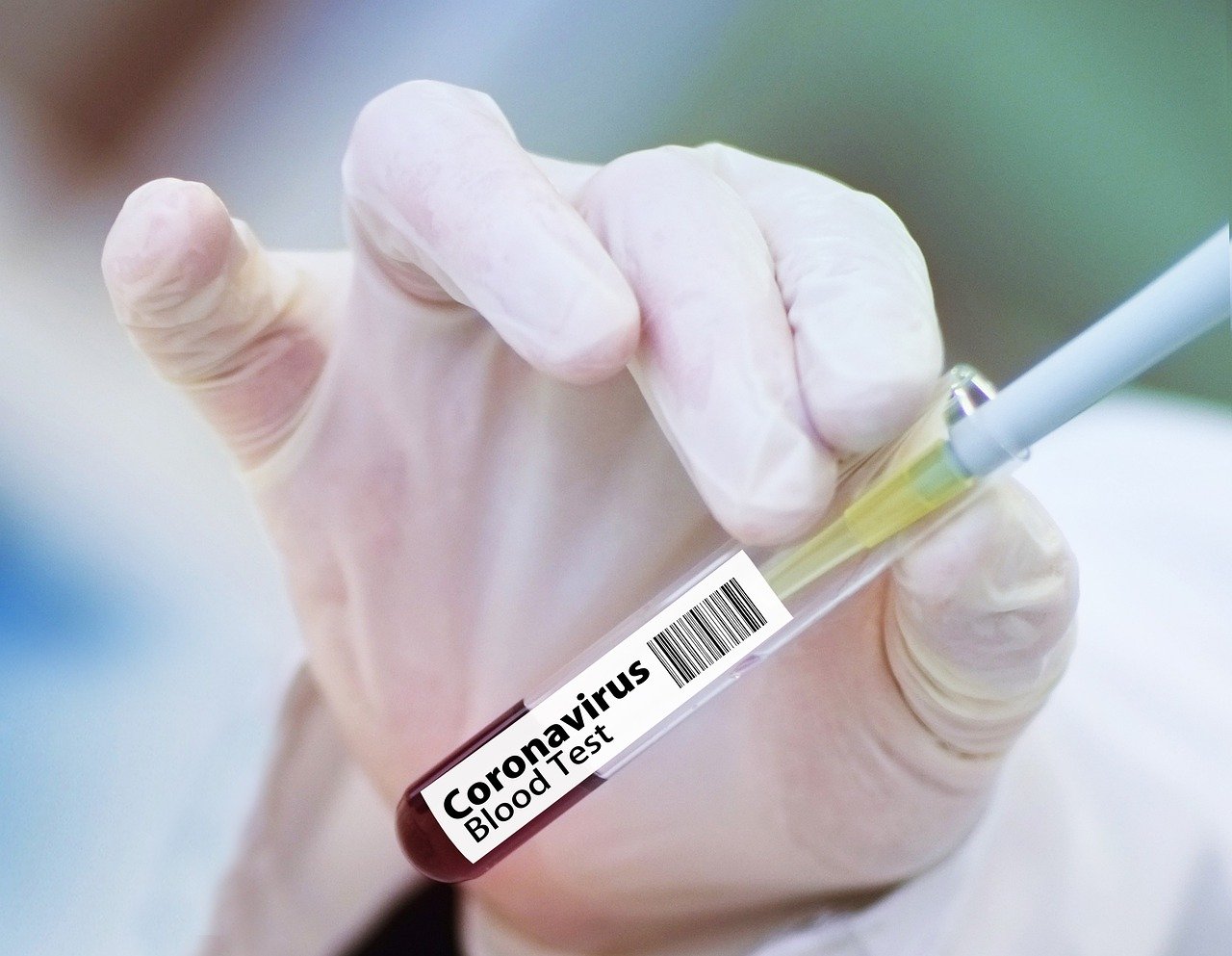 Apesar do avanço de novas variantes, Brasil reduz exames para sequenciar coronavírus. Foto: Pixabay