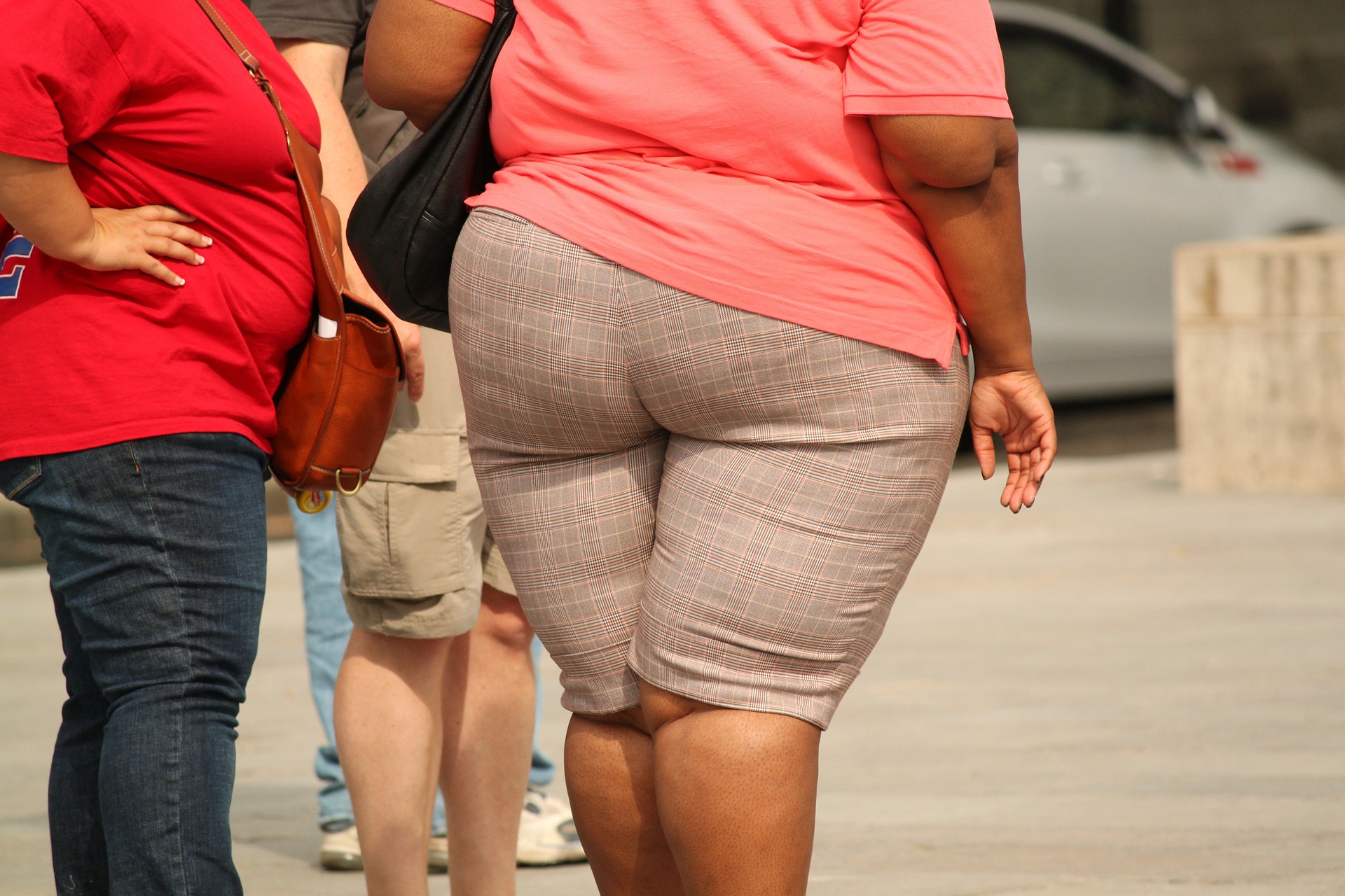 Obesidade. Foto: Pixabay