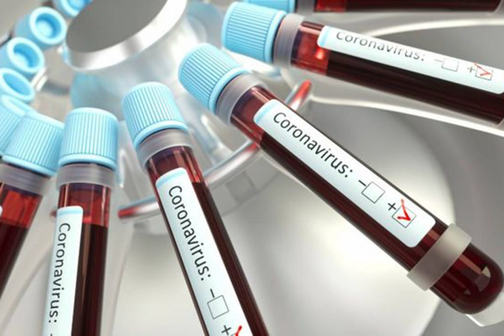 OMS: testes populacionais amplos de covid-19 nem sempre são úteis. Foto: Reprodução