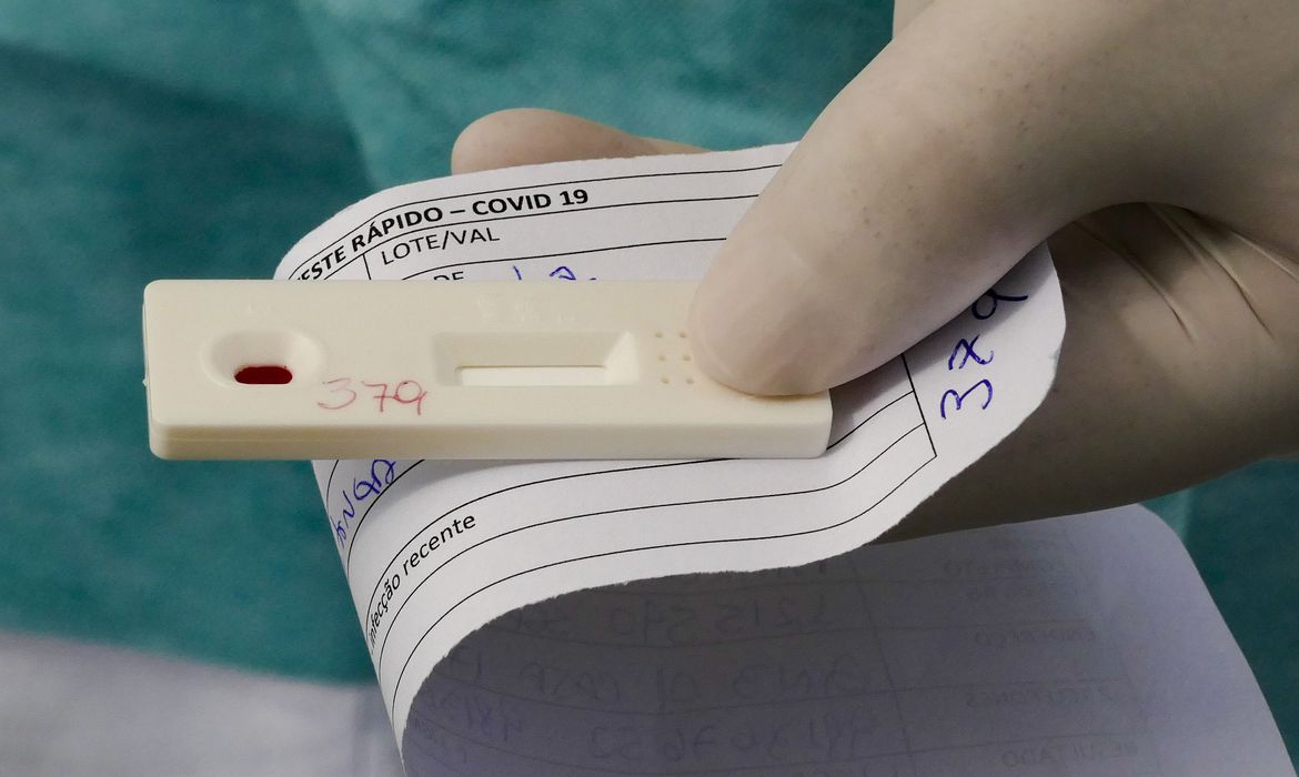 Milhares de testes estocados nos Estados também vencem a partir de dezembro. Foto: Leopoldo Silva/Agência Brasil