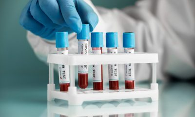 Vacinados com meia dose da AstraZeneca em Viana atingiram 99,8% de imunidade. Foto: FreePik