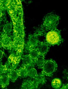 Espírito Santo registra 4 mortes e 234 casos do novo coronavírus nas últimas 24h. Foto: CDC/Pexels