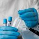 Teste RT-PCR para covid-19. Foto: FreePik