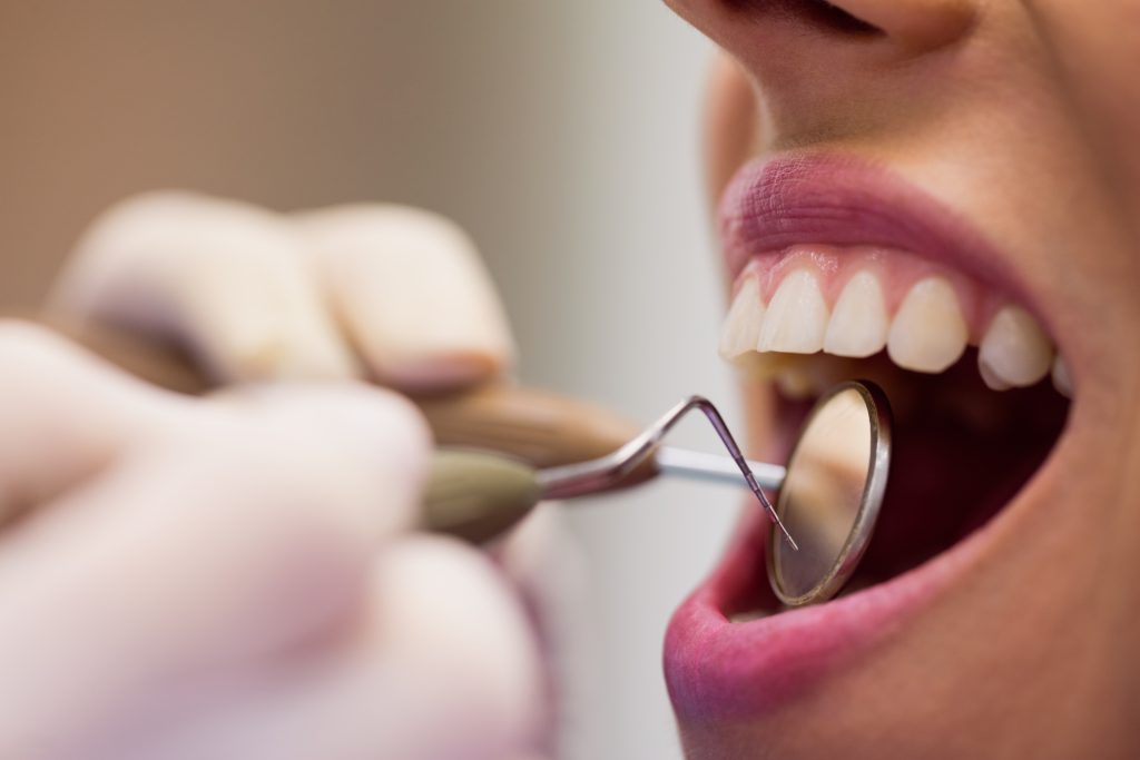 Mulher com a boca aberta para o dentista verificar os dentes - saúde bucal