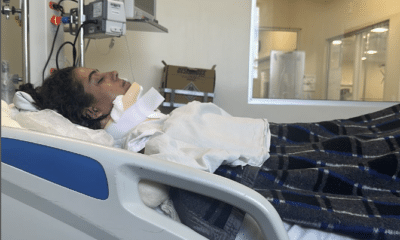 Lindalva Firma deitada em uma cama de hospital na enfermaria. A jovem está paraplégica após lesão durante acidente na Acro-Yoga.
