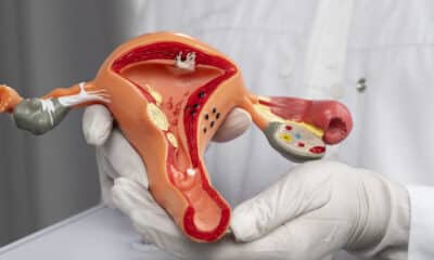 Um médico de luvas com uma réplica de Modelo do trato gastro-intestinal