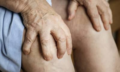Duas mãos segurando um joelho com artrose de uma idosa de saia azul