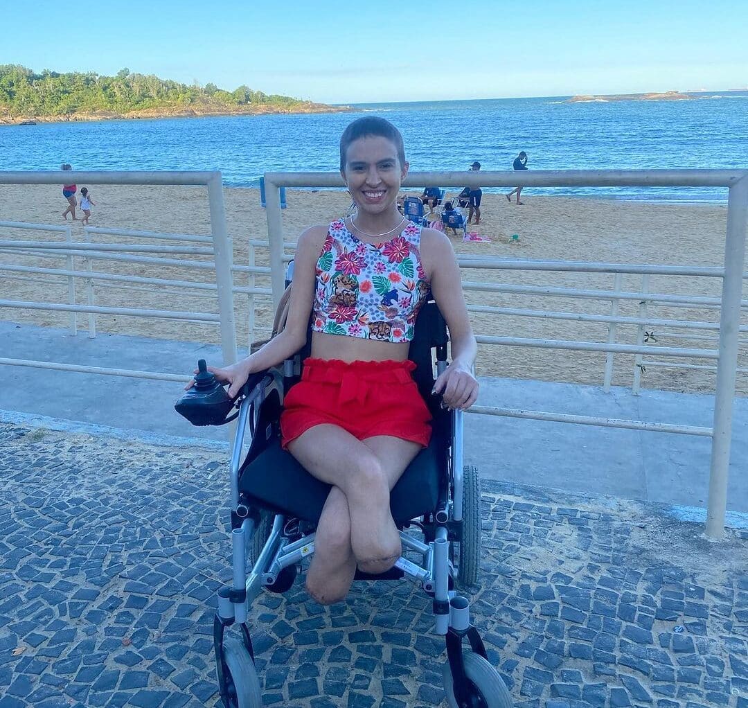 Bianca Andrade teve as duas pernas amputadas enquanto enfrentava um câncer