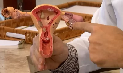 Endometriose pode ser doença genética, hormonal, imunológica ou menstrual. Foto: Reprodução/Agência Brasil