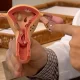 Endometriose pode ser doença genética, hormonal, imunológica ou menstrual. Foto: Reprodução/Agência Brasil