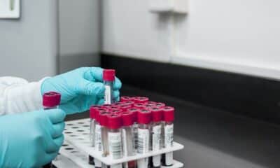 Teste de hepatite
