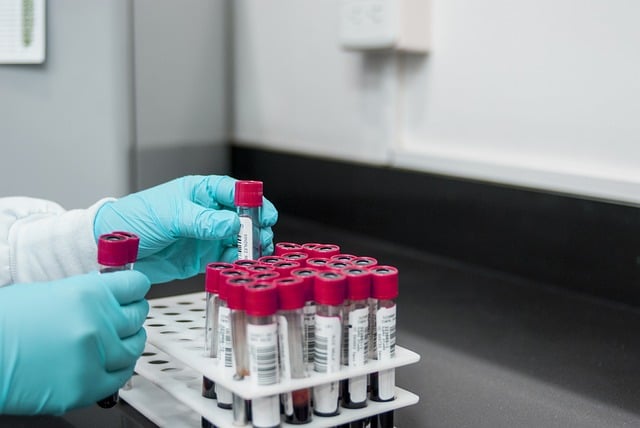 Teste de hepatite