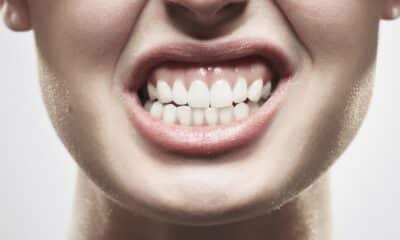 O bruxismo pode causar dor facial e desgaste nos dentes, mesmo sem que a pessoa perceba. Foto: Freepik