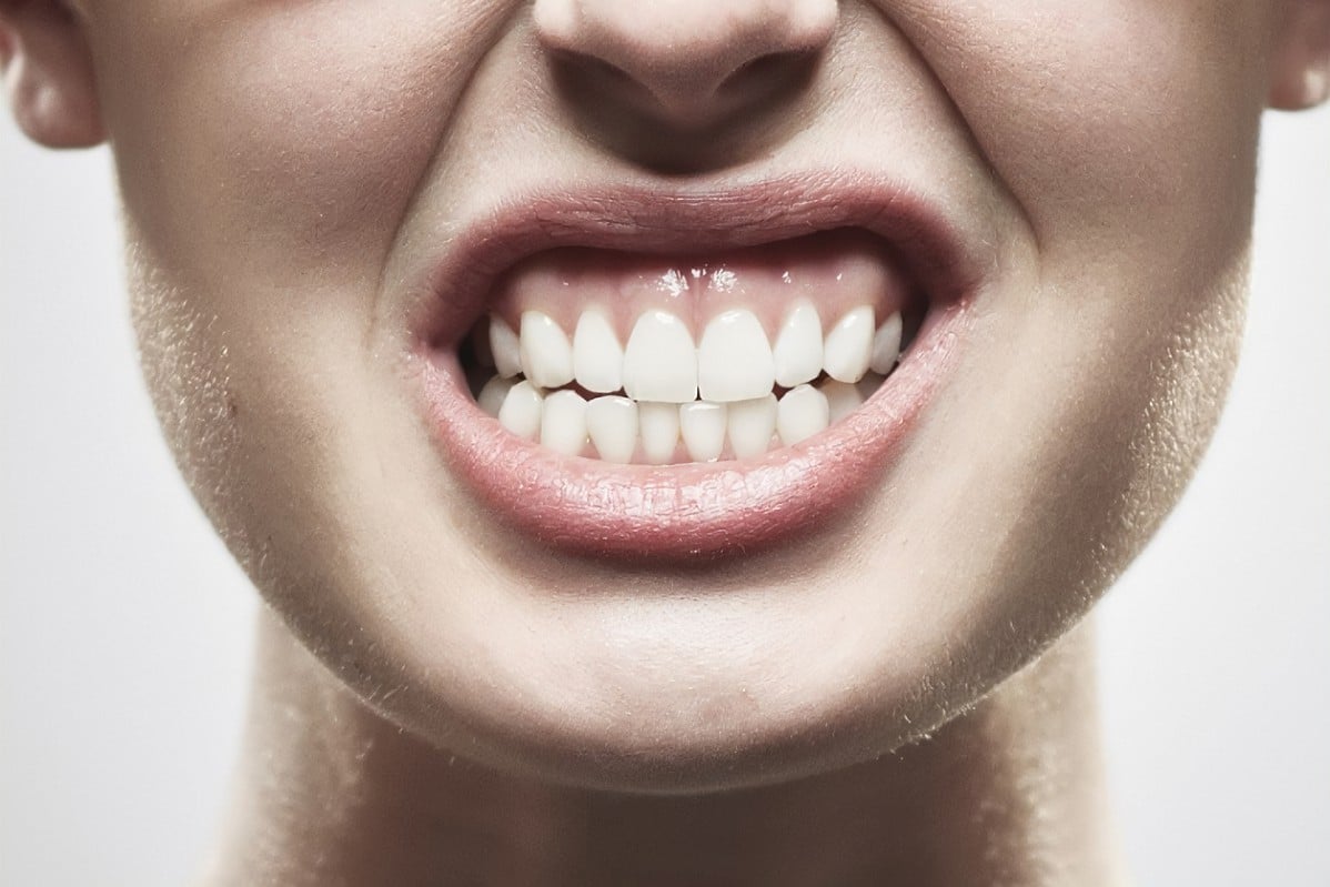 O bruxismo pode causar dor facial e desgaste nos dentes, mesmo sem que a pessoa perceba. Foto: Freepik