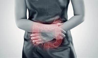 Cansaço inexplicável, inchaço e dificuldade de emagrecer? Pode ser disbiose intestinal sabotando seu metabolismo. Foto: Reprodução/UL-250