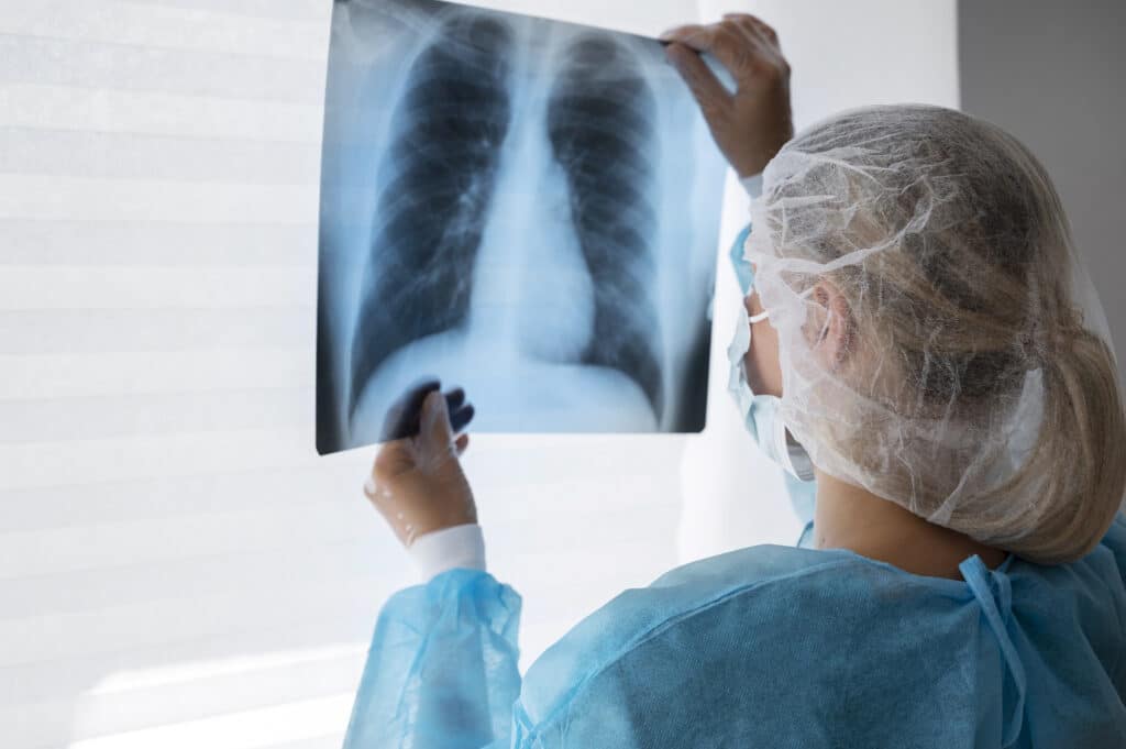 Bronquiolite obliterante é chamada de pulmão de pipoca. Foto: Freepik