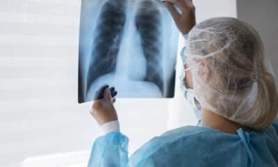 Bronquiolite obliterante é chamada de pulmão de pipoca. Foto: Freepik