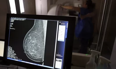 Mamografia SUS passa a ser indicada a partir dos 40 anos. Foto: Agência Brasil