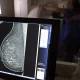 Mamografia SUS passa a ser indicada a partir dos 40 anos. Foto: Agência Brasil