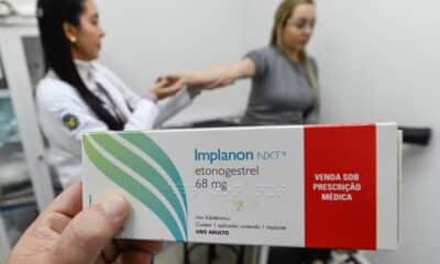 implanon