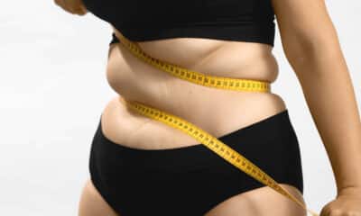 Cirurgia bariátrica